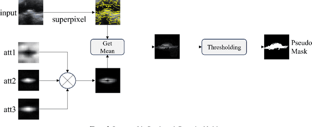 Figure 3 for WAL-Net: Weakly supervised auxiliary task learning network for carotid plaques classification