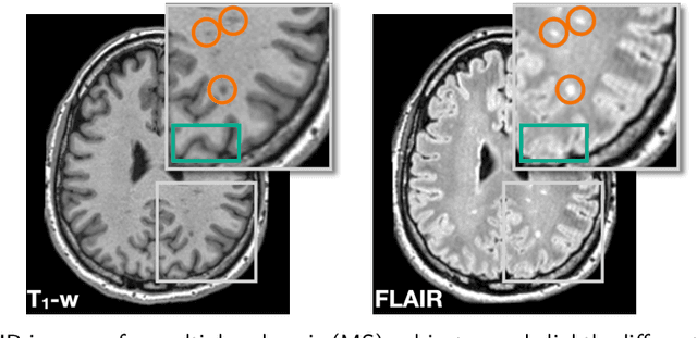 Figure 3 for HACA3: A Unified Approach for Multi-site MR Image Harmonization