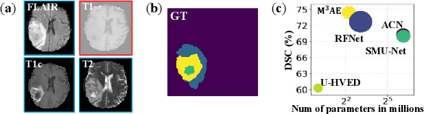 Figure 1 for M3AE: Multimodal Representation Learning for Brain Tumor Segmentation with Missing Modalities