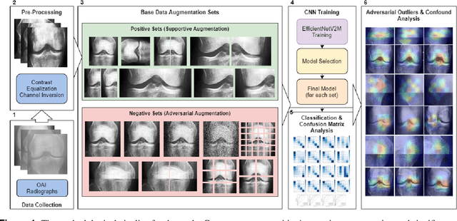 Figure 1 for Exploring the Efficacy of Base Data Augmentation Methods in Deep Learning-Based Radiograph Classification of Knee Joint Osteoarthritis