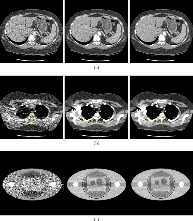 Figure 1 for Statistically Adaptive Filtering for Low Signal Correction in X-ray Computed Tomography