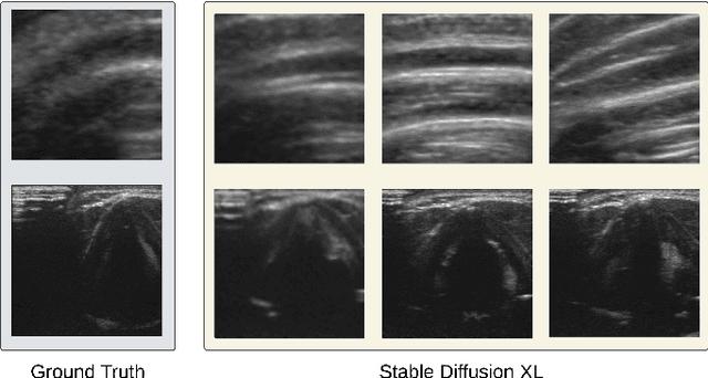 Figure 3 for T2ID-CAS: Diffusion Model and Class Aware Sampling to Mitigate Class Imbalance in Neck Ultrasound Anatomical Landmark Detection