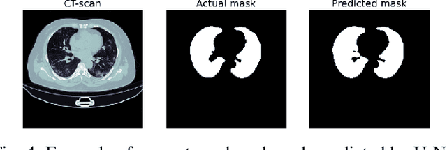 Figure 4 for CT-xCOV: a CT-scan based Explainable Framework for COVid-19 diagnosis