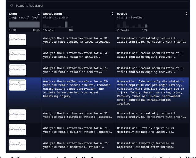 Figure 4 for Standardization of Neuromuscular Reflex Analysis -- Role of Fine-Tuned Vision-Language Model Consortium and OpenAI gpt-oss Reasoning LLM Enabled Decision Support System