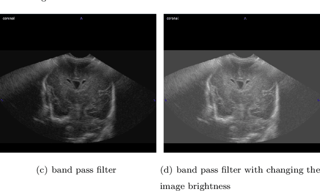 Figure 2 for MELAGE: A purely python based Neuroimaging software (Neonatal)
