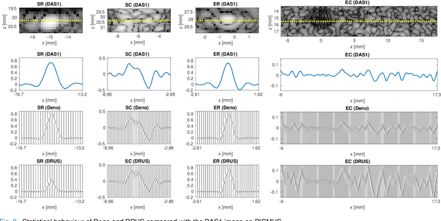 Figure 2 for Diffusion Reconstruction of Ultrasound Images with Informative Uncertainty