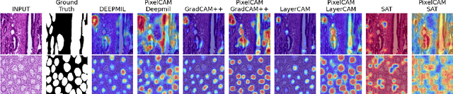 Figure 3 for PixelCAM: Pixel Class Activation Mapping for Histology Image Classification and ROI Localization