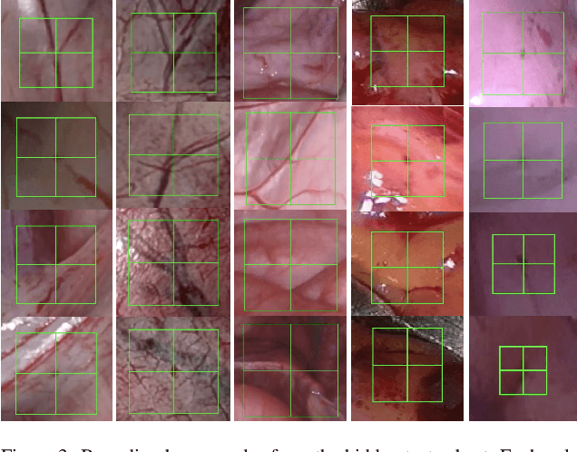 Figure 4 for SurgT challenge: Benchmark of Soft-Tissue Trackers for Robotic Surgery