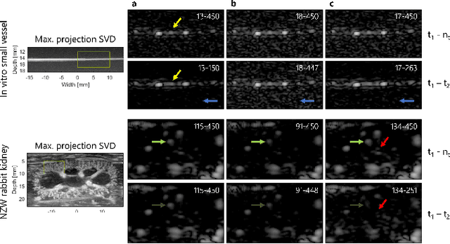 Figure 3 for On the Use of Singular Value Decomposition as a Clutter Filter for Ultrasound Flow Imaging