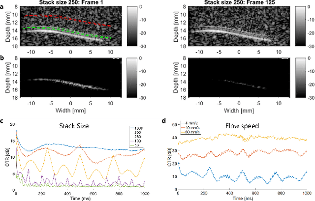 Figure 4 for On the Use of Singular Value Decomposition as a Clutter Filter for Ultrasound Flow Imaging