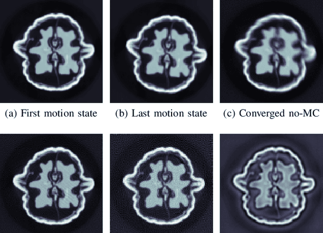 Figure 2 for Accelerated Convergent Motion Compensated Image Reconstruction