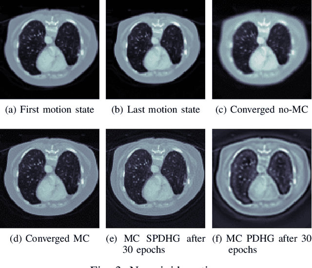 Figure 3 for Accelerated Convergent Motion Compensated Image Reconstruction