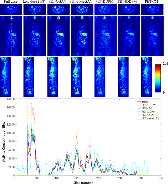 Figure 2 for Full-dose PET Synthesis from Low-dose PET Using High-efficiency Diffusion Denoising Probabilistic Model