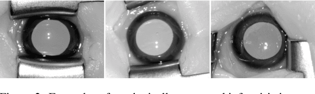 Figure 3 for Iris Recognition for Infants