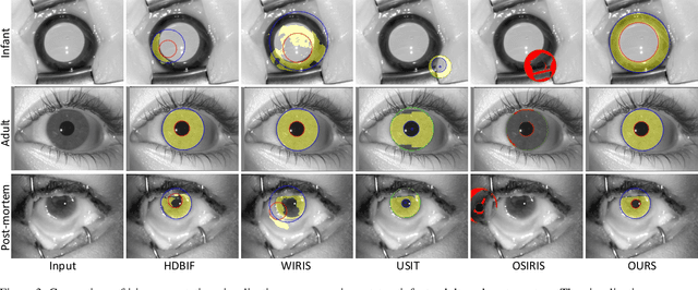 Figure 4 for Iris Recognition for Infants