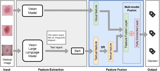 Figure 3 for Multi-Modal One-Shot Federated Ensemble Learning for Medical Data with Vision Large Language Model