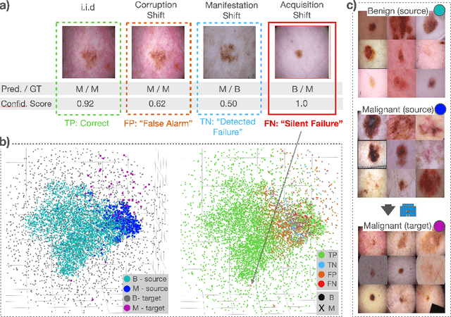 Figure 1 for Understanding Silent Failures in Medical Image Classification