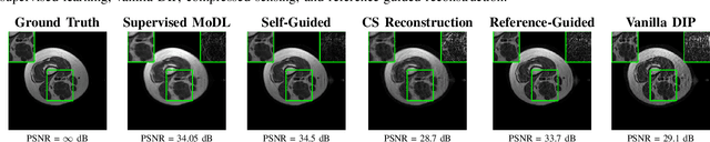 Figure 2 for Analysis of Deep Image Prior and Exploiting Self-Guidance for Image Reconstruction