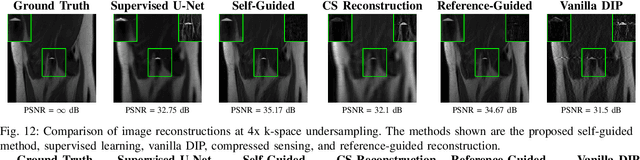 Figure 3 for Analysis of Deep Image Prior and Exploiting Self-Guidance for Image Reconstruction