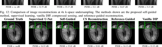 Figure 4 for Analysis of Deep Image Prior and Exploiting Self-Guidance for Image Reconstruction