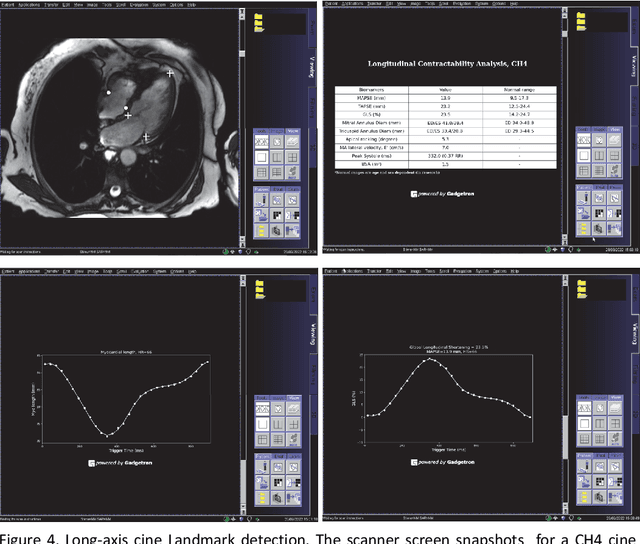 Figure 4 for Inline AI: Open-source Deep Learning Inference for Cardiac MR