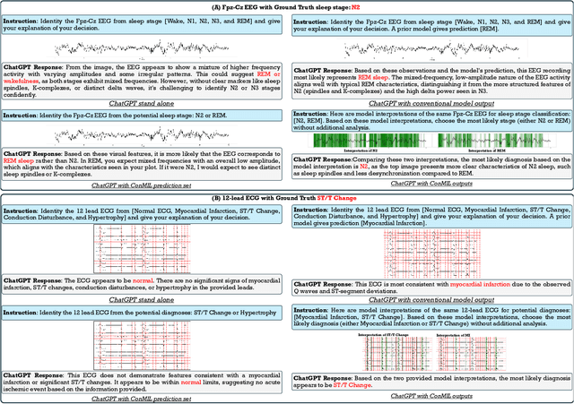 Figure 3 for Enhancing Visual Inspection Capability of Multi-Modal Large Language Models on Medical Time Series with Supportive Conformalized and Interpretable Small Specialized Models