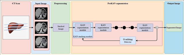 Figure 1 for ProKAN: Progressive Stacking of Kolmogorov-Arnold Networks for Efficient Liver Segmentation