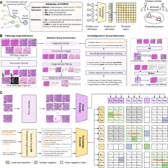 Figure 2 for A Knowledge-enhanced Pathology Vision-language Foundation Model for Cancer Diagnosis