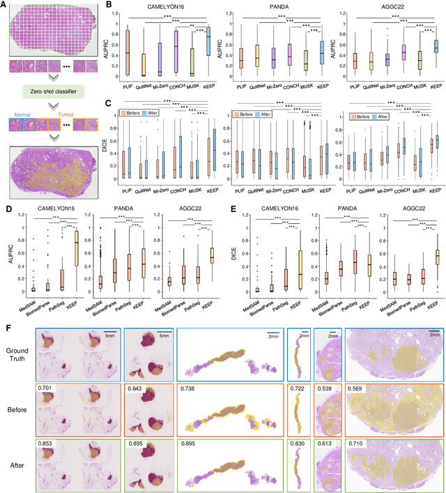 Figure 3 for A Knowledge-enhanced Pathology Vision-language Foundation Model for Cancer Diagnosis