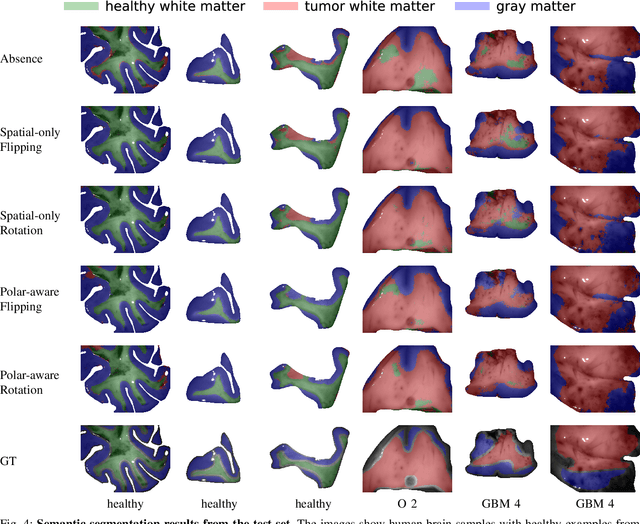 Figure 4 for Isometric Transformations for Image Augmentation in Mueller Matrix Polarimetry