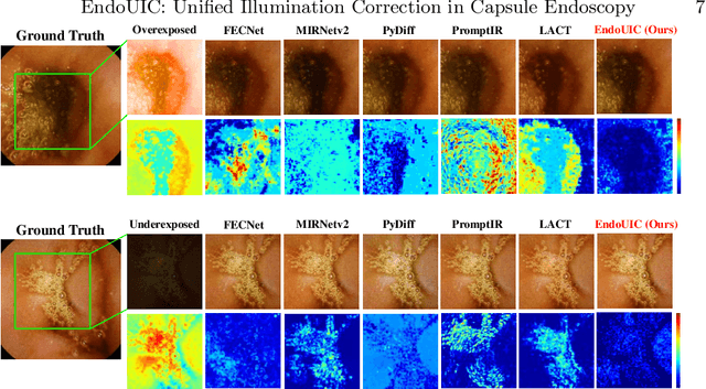 Figure 3 for EndoUIC: Promptable Diffusion Transformer for Unified Illumination Correction in Capsule Endoscopy