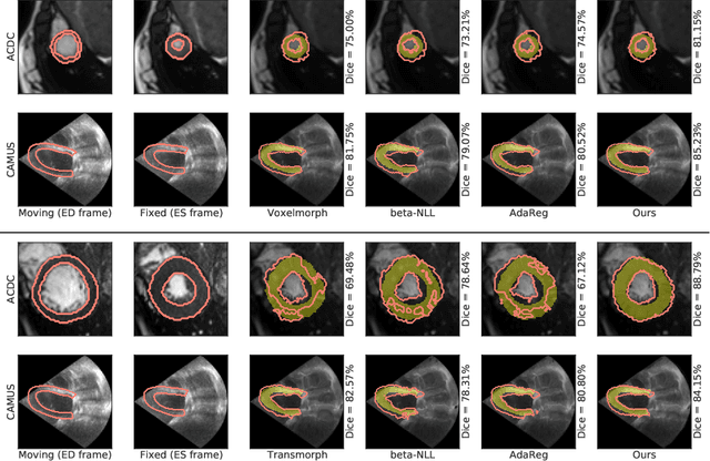 Figure 2 for Heteroscedastic Uncertainty Estimation for Probabilistic Unsupervised Registration of Noisy Medical Images