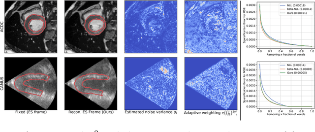 Figure 4 for Heteroscedastic Uncertainty Estimation for Probabilistic Unsupervised Registration of Noisy Medical Images