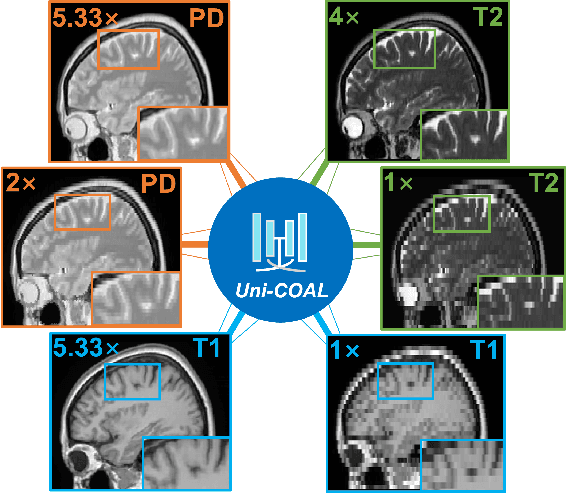 Figure 1 for Uni-COAL: A Unified Framework for Cross-Modality Synthesis and Super-Resolution of MR Images