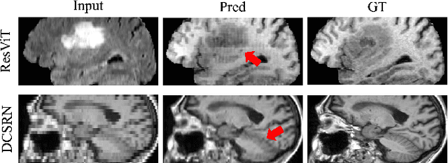 Figure 2 for Uni-COAL: A Unified Framework for Cross-Modality Synthesis and Super-Resolution of MR Images