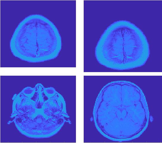 Figure 4 for Distribution-aware $\ell_1$ Analysis Minimization