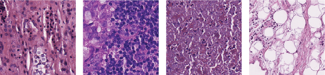 Figure 1 for PathMoCo: A Novel Framework to Improve Feature Embedding in Self-supervised Contrastive Learning for Histopathological Images