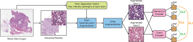 Figure 3 for PathMoCo: A Novel Framework to Improve Feature Embedding in Self-supervised Contrastive Learning for Histopathological Images