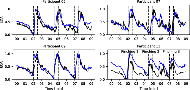 Figure 3 for SympCam: Remote Optical Measurement of Sympathetic Arousal