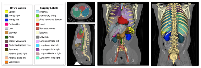 Figure 1 for CT-based Anatomical Segmentation for Thoracic Surgical Planning: A Benchmark Study for 3D U-shaped Deep Learning Models