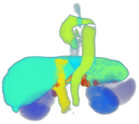 Figure 1 for Runtime Freezing: Dynamic Class Loss for Multi-Organ 3D Segmentation