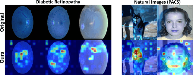 Figure 4 for Exploring the Transfer Learning Capabilities of CLIP in Domain Generalization for Diabetic Retinopathy