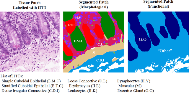 Figure 1 for HistoSegCap: Capsules for Weakly-Supervised Semantic Segmentation of Histological Tissue Type in Whole Slide Images