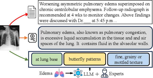 Figure 3 for Decomposing Disease Descriptions for Enhanced Pathology Detection: A Multi-Aspect Vision-Language Matching Framework