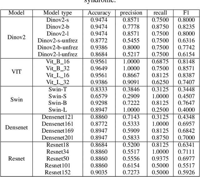 Figure 4 for Comparative Analysis of Pre-trained Deep Learning Models and DINOv2 for Cushing's Syndrome Diagnosis in Facial Analysis