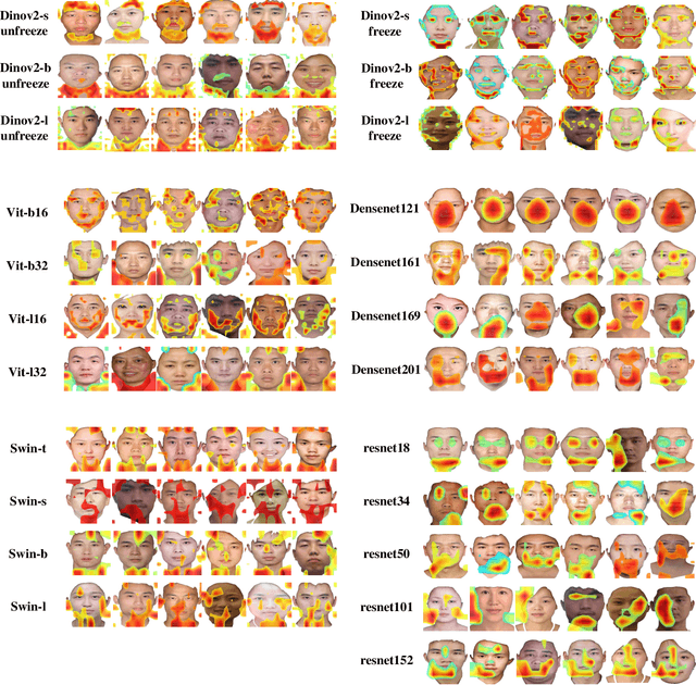 Figure 2 for Comparative Analysis of Pre-trained Deep Learning Models and DINOv2 for Cushing's Syndrome Diagnosis in Facial Analysis