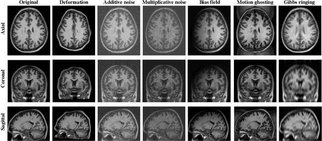 Figure 2 for Yucca: A Deep Learning Framework For Medical Image Analysis