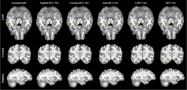 Figure 3 for Yucca: A Deep Learning Framework For Medical Image Analysis