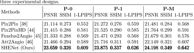 Figure 4 for Learn Single-horizon Disease Evolution for Predictive Generation of Post-therapeutic Neovascular Age-related Macular Degeneration