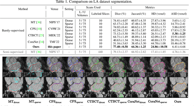 Figure 2 for Orthogonal Annotation Benefits Barely-supervised Medical Image Segmentation